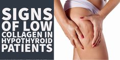 Signs of Low Collagen In Hypothyroid Patients Under Active Thyroid Symptoms, Signs Of Thyroid Trouble, Natural Thyroid Support, Nodules On Thyroid, Nodules On Thyroid Glands, Thyroid Symptoms, Thyroid Medication, Thyroid Issues, Thyroid Hormone