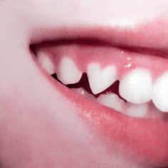 a woman's mouth with white teeth and gums