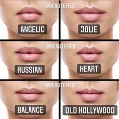 Types Of Lips Shape, Heart Shaped Lips, Lips Inspiration, Lip Types, Face Fillers, Permanente Make-up, Botox Lips, Facial Fillers, Facial Aesthetics