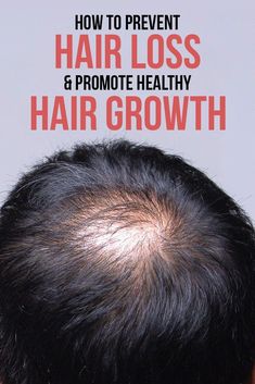 Dealing with hair loss, brittle nails or damaged hair? Check minerals and vitamins that can help your hair get healthier and nails get stronger. Hair Growth For Men Remedies, Men Hair Growth Tips, Hair Growth Tips For Men, Hair Care Men, Hair Lossing, Hair Regrowth For Men, Men Hair Growth, Hair Fall Men, Hairdresser Logo