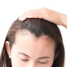 How to Stop and Regrow a Receding Hairline: Best Treatments | Allure Uneven Hairline, Hair Rebonding, Digital Makeup, Haircuts For Receding Hairline, Thinning Hairline, Hairstyles For Receding Hairline, Receding Hair Styles, Medical Tattoo, Part Hair