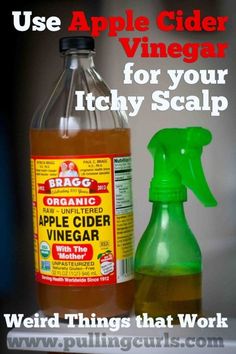 Itchy Scalp Causes, Itchy Scalp Remedy, Thick Hair Remedies, Itchy Scalp, Hair Remedies, Dry Scalp, Dandruff