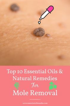 Essential Oil Wart Remover Recipe, Skin Tags Essential Oils, Remove Moles, Skin Care Routine For 20s, Mole Removal, Skin Tags, Natural Healing Remedies, Essential Oils For Skin, Essential Oil Benefits