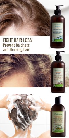 Just Nutritive, Shampoo For Thinning Hair, Hair Therapy, Baking Soda Shampoo, Hairstyles Women, Hair Control, Hair Help, Hair Product, Hair Remedies