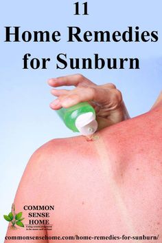 11 remedies for sunburn relief, to heal burning, itching and peeling. Safe options for your face, blister treatment, tips for a soothing bath & more. Burn Remedies, Sunburn Remedy, Remedies For Sunburn, Cleansing Recipes, What Causes Warts, Autogenic Training, Types Of Warts