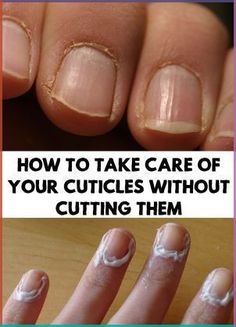 Skin Care Routine For Teens, Cuticle Care, Nail Growth, Nail Cuticle, Pregnancy Health, Nail Fungus, Nail Health