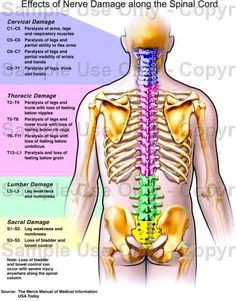 Effects of Nerve Damage along the Spinal Cord. Source; The Merck Manual of Medical Information USA Today. found on vcharkarn.com Spinal Nerves Anatomy, Nerve Anatomy, Spinal Nerve, Spine Health, Medical Facts, Human Anatomy And Physiology, Medical Anatomy, Nerve Damage