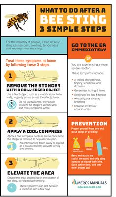 Bee Sting Remedy, Remedies For Bee Stings, First Aid For Kids, School Nurse Office, Wasp Stings, First Aid Cpr, First Aid Tips, Emergency Prepardness, Emergency Preparedness Kit