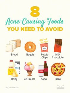 Can eating certain foods give you pimples and breakouts? Check out these eight acne-causing foods you need to quit eating immediately for clearer skin! Acne Causing Foods, Fatty Foods, Pinterest Food, Skin Care Routine For 20s, Toenail Fungus, Clearer Skin, Acne Free, Cream Soda