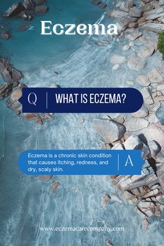 #eczema #eczemaskin #eczemaskincare #naturalskincare #skincare #qa #didyouknow #questions Scaly Skin, Skin Conditions, Natural Skin Care, Did You Know, Conditioner, Skin Care, Skin