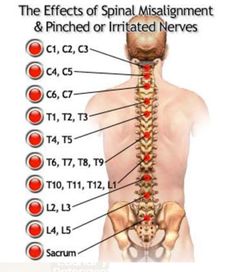 Anatomy Muscles, Anatomy Medical, Student Tips, Spinal Nerve, Accident Injury, Human Body Anatomy, Reflexology Massage