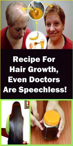 Hair Thickening Remedies, Make Your Hair Grow Faster, Regrow Hair Naturally, Hair Grow Faster, Shampoo For Gray Hair, Help Hair Grow, How To Grow Your Hair Faster, Hair Cleanser, Growth Hair