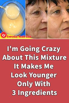 Wrinkles Remedies Face, Natural Facial Mask, Get Rid Of Wrinkles, Wrinkle Remedies, Erase Wrinkles, Skin Care Wrinkles, Younger Skin, Face Wrinkles, Healthy Skin Tips