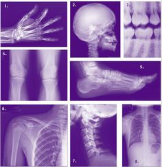 an x - ray shows the different bones and their functions