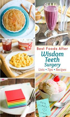 What Can I Eat After Wisdom Teeth Removal? Wisdom Teeth Diet, Soft Foods After Tooth Extraction, Wisdom Tooth Care Package, Soft Meals After Surgery Teeth, Wisdom Teeth Recovery Food, Soft Foods After Surgery Teeth, Wisdom Illustration, Wisdom Teeth Care Package