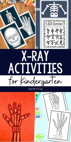 an image of x - ray activities for children