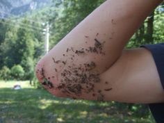 a person holding out their arm with some dirt on it and trees in the background