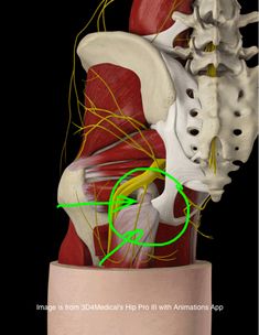 13 Top Tips that will help your Proximal Hamstring Tendinopathy | POGO Physio Gold Coast Occupational Therapy Kids, Field Athletes, Track And Field Athlete, Hippie Life, Hip Pain, Muscle Pain, Sciatica, Occupational Therapy