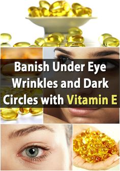 Genius Frugal Beauty Treatment: Banish Under Eye Wrinkles and Dark Circles with Vitamin E Diy Kosmetik, Wrinkle Cream, Eye Bags, Homemade Beauty Products