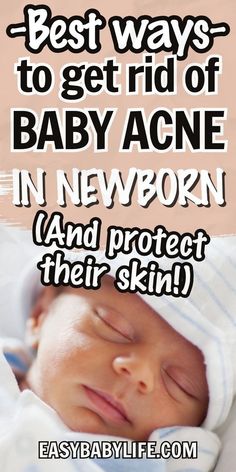 a baby is sleeping with the words best ways to get rid of baby acne in newborn