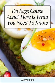 Discover the truth about eggs and acne. Uncover the facts behind this common myth and take control of your skin health today!