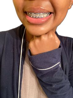 Braces Colors On Dark Skin, Brace Tips, Dark Blue Braces, Navy Blue Braces, Power Chain Braces, Blue Braces, Braces And Glasses