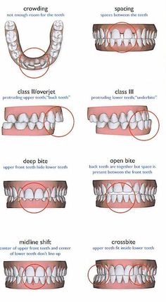 Dental Assistant Study Guide, Dental Assistant School, Dental Hygienist School, Dental Assistant Study, Dental Hygiene Student, Dental Videos, Kedokteran Gigi, Dental Hygiene School, Dentistry Student