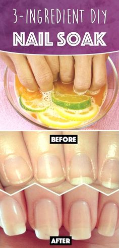 DIY 3-ingredient nail soak for stronger, healthier nails!  Try it now. Diy Nail Soak, Nail Soak, How To Grow Nails, Brittle Nails, Nail Growth, Nail Health