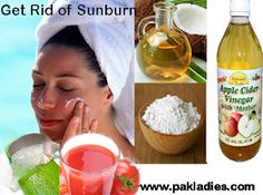 Face Sunburn Remedies, Sunburn On Face, Vinegar For Sunburn, Best For Sunburn, Sunburn Face, Sunburnt Face, Face Dry Skin