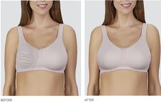 Partial Breast Form can be used to fix uneven breast size to restore shape and beauty after mastectomy Breast Implant Removal, Implant Removal, Mastectomy Bras, Breast Reconstruction, Adaptive Clothing, Mastectomy Bra, Bra Inserts, Fashion Forms, Bra Pads