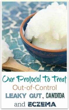 Coconut Oil To Treat Leaky Gut, Candida, [& Surprisingly Diabetes]. Serious help for leaky gut, eczema and serious overgrowth of candida albicans. #recipes #healthy #food #wellness #healthyrecipes #medicine #health #fitness #healing #antiaging #natural #naturalremedies #fitnessaddict #wisdom #faith #kids #coconutoil #mentalhealth #candida #leakygut #antiinflammatory #adhd #gaps Food Wellness, Bad Bugs, Candida Diet Recipes, Holistic Health Remedies, Candida Albicans, Candida Diet