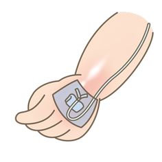 an illustration of a hand with a cast on it's arm holding a device