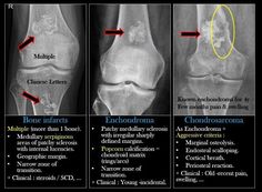 an x - ray shows the different stages of knee surgery and how they are performed