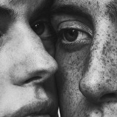 two people with freckles covering their faces