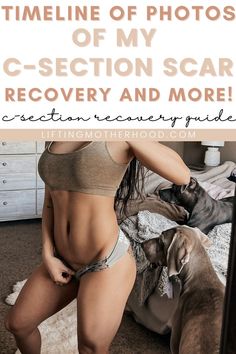 C Section Scar, Body Weight Hiit Workout, Healthy Pregnancy Food, C Section Scars, C Section Recovery, Losing 40 Pounds