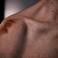 the back of a man with brown spots on his chest