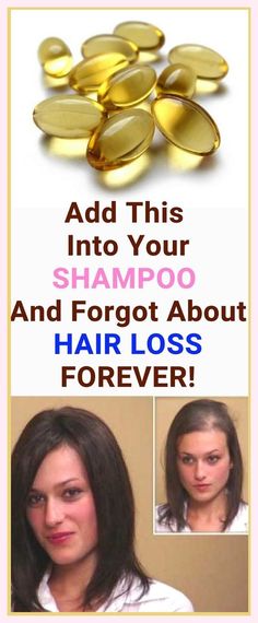 She Added This into Her SHAMPOO and Forgot About Hair Loss FOREVER! She Now Recommends Her Trick To Everyone! Grow Hair Faster, Hair Remedies, Natural Beauty Tips, Shampoos, Hair Health, Grow Hair, العناية بالشعر, About Hair