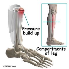 Anterior Shin Splints, Broken Fibula, Lower Leg Pain, Magnetic Resonance Imaging, Musculoskeletal System, Treadmill Workout, The Shins