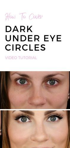 Dark Under Eye Circles, Angela Lanter, Under Eye Circles, Eye Tricks