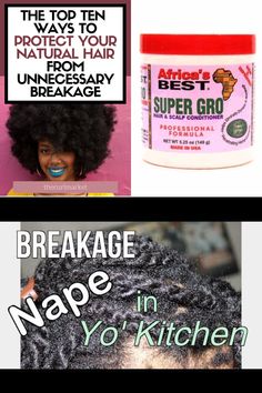 treatment for damaged hair Scalp Conditions, Hair Scalp, Natural Hair Styles, Conditioner, Hair