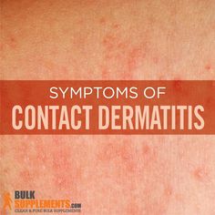 Contact dermatitis is a non-contagious skin disease experienced by nearly a million people in the United States annually. Contact Dermitis Hands, Skin Irritation Remedies, Home Remedies For Rashes, Rash On Hands, Home Remedies For Face, Skin Fungus, Rash On Face, Rashes Remedies, How To Become Healthy