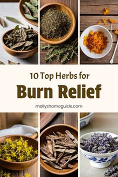 Natural Burn Remedies, Herbal First Aid Kit, Herbal First Aid, Burn Relief, How To Heal Burns, Treat Burns, Medicinal Herbs Garden, Herbal Recipes