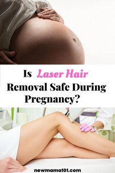 laser hair removal while breastfeeding Laser Hair