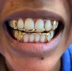 Gold Teeth Grills, Girl Grillz, Dental Jewelry, Grillz Teeth, Diamond Grillz, Gold Grill, Windows To The Soul, Diamond Teeth, Dope Jewelry Accessories