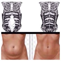 Diástase Abdominal, Diastasis Recti Exercises, Body After Baby, Modele Fitness, Trening Fitness, Diastasis Recti, Post Pregnancy, Diet Keto