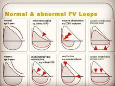 the normal and abnormal fv loops are shown in this diagram, which shows how to measure