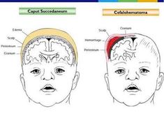 an image of the human head with different areas labeled in each section, including celebratorys and cranins