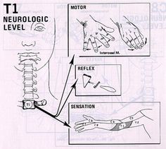 Neurological Assessment, Nerve Anatomy, Massage Therapy Techniques, Trigger Point Therapy, Ayurvedic Healing, Hand Therapy, Medical Terms