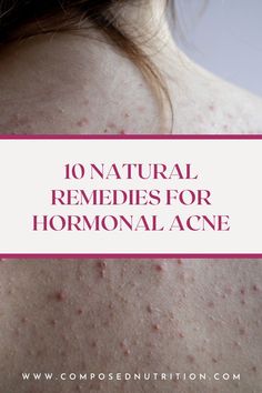 Not sure which natural remedies can improve hormonal acne? In this post you’ll learn which whole foods and supplements can aid in improving hormonal acne and cyclical skin issues. Check out more acne remedies and hormone hacks at composednutrition.com. Remedies For Hormonal Acne, Foods That Contain Zinc, Hormone Hacks, Causes Of Acne, Balance Diet, Hormone Balancing Diet, Foods To Balance Hormones