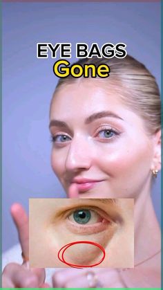 💚Get rid of eye bags with these simple exercises that you can do anywhere, anytime! 💪💫
#fitness  #homeworkout #weightlossmotivation #health How To Reduce Eye Bags Naturally, Bag Eyes How To Get Rid, How To Treat Eye Bags, How To Fix Bags Under Eyes, Instant Eye Bag Removal, How To Get Rid Of Under Eye Bags Fast, Eye Bag Exercises, Face Yoga For Eye Bags, How To Get Doe Eyes Exercise